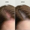 Scalp Sensitive Serum 50ml