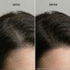Dandruff Detox Shampoo 300ml