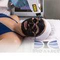 Laser Syrius Ibramed