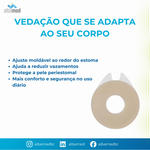 Anel Moldável Brava 4.2mm Kit 5 Unidades Coloplast