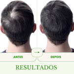 Minoxidil 5% + Finasterida 1% + Pill food capilar