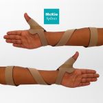 Faixa de Supinação Infantil Mckie Splint – Órtese Terapêutica para Função Manual Infantil