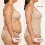 Camisete Modeladora DeLinea Fisiovital | Cinta Pós-Cirúrgica Modela Tronco e Postura