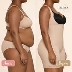 Macacão Modelador DeLinea Body com Perna Fisiovital | Cinta Pós-Cirúrgica Compressão Total