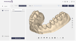 Scanner 3D - MegaScan Pro - Odontomega
