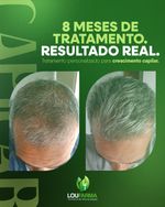 Crescimento Capilar em Spray 120mL – Loufarma