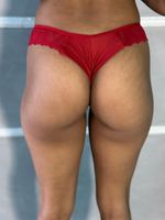 Conjunto Verônica - Renda sem bojos - Rubi