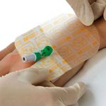 CURATIVO IV3000 7cm X 9cm SMITH&NEPHEW