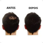 Kit Aplicador + Fibra Capilar Preta – Resultado Natural e Imediato