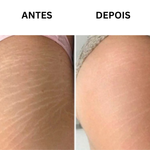 CREME ANTIESTRIAS 200G