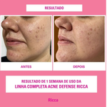 TONICO FACIAL RICCA 140ML 3796