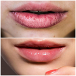 HIDRATANTE LABIAL FPS30 NEUTRO BLISTER  2200