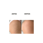 CREME MASSAGEM PREVENCAO ESTRIAS 200ML