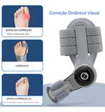 CORRETOR ORTOPEDICO CINZA ROTATIVO HALLUX VALGO P/JOANETE