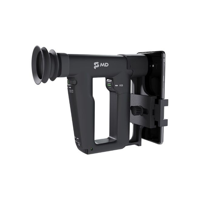 Oftalmoscópio Digital Indireto Eyescope MD – Tecnologia e Precisão em Diagnósticos
