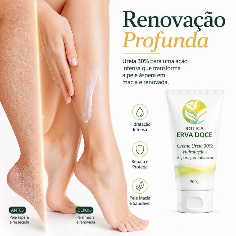 Creme Ureia 30% – Hidratação e Reparação Intensiva 200g