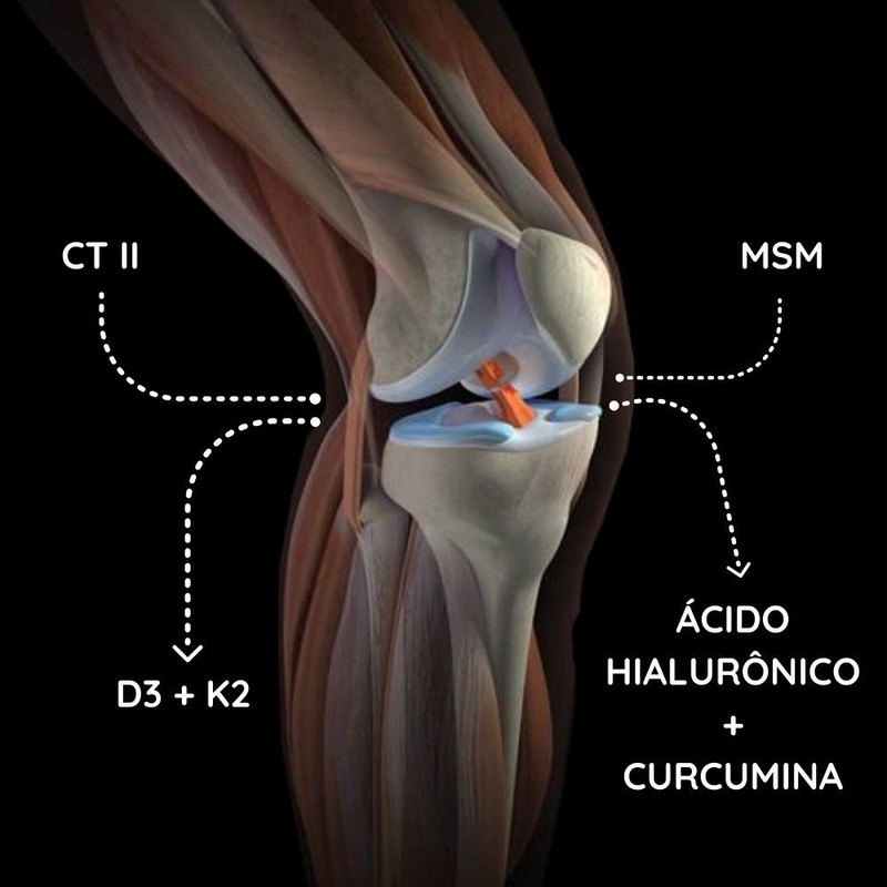 SOS Joints (Articulações) 60 Cápsulas Therapeutica Elements